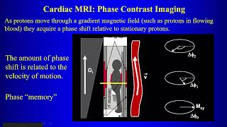 5b Cardiac MRI P2 [upl. by Moreen]