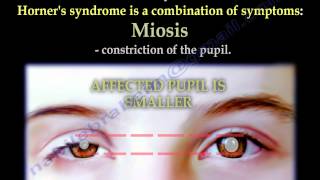 The Brachial Plexus amp Horners Syndrome  Everything You Need To Know  Dr Nabil Ebraheim [upl. by Daryl]