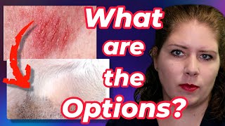 Treatments for Allergies  Vets Voice Atopic Dermatitis Part 2 [upl. by Yanad701]