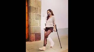 Clip 635 Broken leg cast crutches part 2 [upl. by Hosea569]