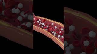 Platelets and plasma in blood [upl. by Pollack]