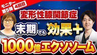 【1000億エクソソーム4回目】変形性膝関節症末期に対する再生医療【痛みが治る】 [upl. by Ruthi]