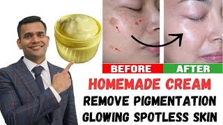 Remove Dark spots Pigmentation And Get Younger Glowing Spotless Skin  Dr Vivek Joshi [upl. by Analat625]