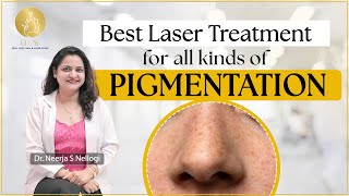 Laser treatment for pigmentation  Best Dermatologist in Mumbai  Dr Neerja S Nellogi [upl. by Aztilay]