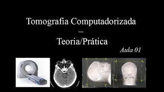 Curso de Tomografia  Aula 1 Gantry Scout FOV Matriz Pixel [upl. by Akinej]