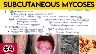 subcutaneous mycoses  mycology  fungi  microbiology mbbs mcwa [upl. by Taggart]