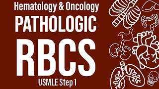 Pathologic RBC Forms HemeOnc  USMLE Step 1 [upl. by Isied]