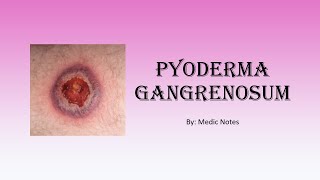 Pyoderma gangrenosum  causes pathophysiology sign value [upl. by Hatnamas]