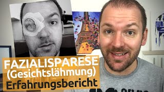 Gesichtslähmung – Diagnose Fazialisparese  Ursache Behandlung Folgen  Thomas Stradner [upl. by Japeth]