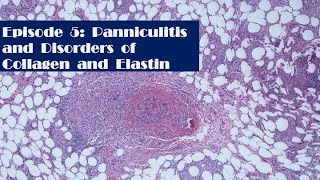 Episode 5 Panniculitis and Disorders of collagen and elastin [upl. by Darsie800]