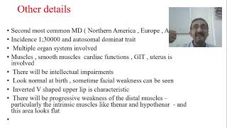 Muscular Dystrophy  Myotonic Dystrophy  Part 10 [upl. by Danyelle]