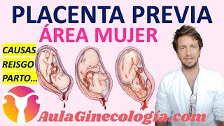 PLACENTA PREVIA CAUSAS RIESGO PARTO  Ginecología y Obstetricia [upl. by Leidba]