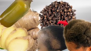 I used GINGER AND CLOVES in my hair then this happenedCLOVES and GINGER for Hair growth [upl. by Sergent]