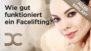 Facelifting amp Halsstraffung Sind natürliche Ergebnisse möglich  Dorow Clinic [upl. by Clair]