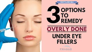 Options to Remove Excess Filler Placement and Treatments to Improve Under Eye Area [upl. by Artemed]