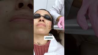 Peeling de fenol 👩🏻‍⚕️✨ [upl. by Sirad564]