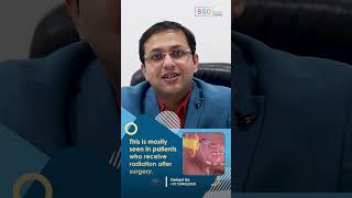 Facial Wounds After Buccal Mucosa Cancer Treatment Causes and Solutions  Dr Amit Chakraborty [upl. by Ainatit]