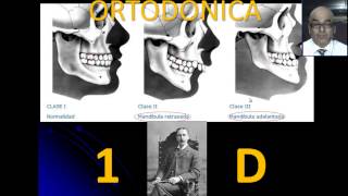 Clasificación de las maloclusiones de Dr Angle ¿Porqué dejar de emplearla [upl. by Margery44]