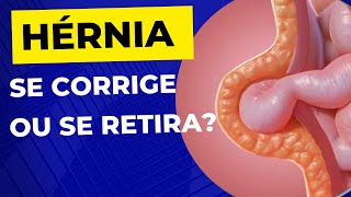 Como é a CIRURGIA DE HÉRNIA A hérnia é retirada [upl. by Narih]