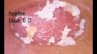 Week16 S1 PorelyDone Pore Blackhead and Oil Vacuum Suction Removal [upl. by Ardyce]