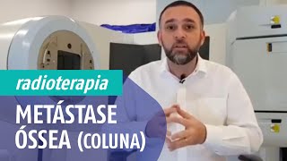 Metástase Óssea Coluna  Radioterapia com Dr Paulo Lázaro [upl. by Aciretahs]