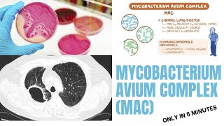 mycobacterium microbiology lecture  Mycobacterium avium complex MAC Easy Microbiology [upl. by Gonagle]