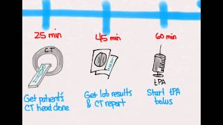 Ischemic Stroke 04 Treatment with tPA [upl. by Trik]
