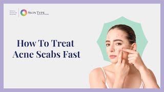 How to Heal Acne Scabs Fast and Easy with Dr Leslie Baumann [upl. by Gillie]