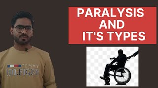 PARALYSIS AND TYPES OF PARALYSIS  URDU \ HINDI [upl. by Ahsat]