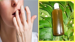 Stop Nail Biting Natural Remedies [upl. by Trometer358]