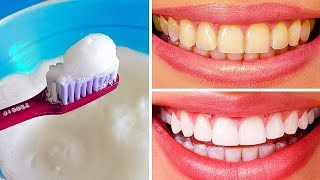 8 astuces maison pour blanchir les dents naturellement [upl. by Spevek]