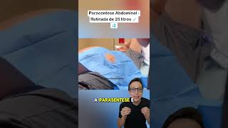 25 Litros de Ascite 😱💉 medicina medico enfermagem tecnicodeenfermagem saude barriga dágua [upl. by Ihp]