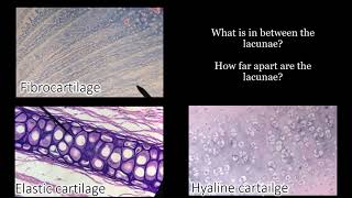 Identifying Cartilage  Review and Practice Questions [upl. by Ecined519]