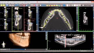 Blue Sky Plan 3 Tutorial  Panoramic Curve [upl. by Loss]