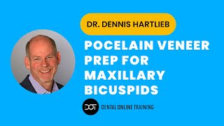 Porcelain Veneer Preparation for Maxillary Bicuspids  Prepless Technique  Dental Online Training [upl. by Bluefarb]