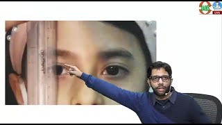 Ptosis IN TOTO Ophthalmology by Dr Sourabh Sharma [upl. by Emmy]