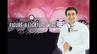 figure8 ligature wire fixation in orthodontics orthodontic finishing [upl. by Dnob]