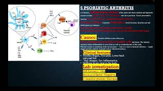 DIFFERENTIAL DIAGNOSIS AND MANAGMENT OF MONOARTHERITIS [upl. by Oiliruam]