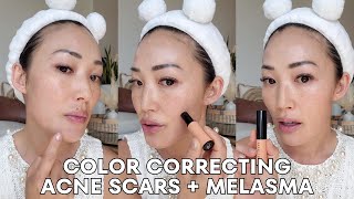 Color Correcting Acne Scars  Melasma  Hyperigmentation [upl. by Hanej]