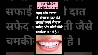 दात को कैसे सफेद बनाए । दात को कैसे चमकीले बनाए । दात को कैसे चमकदार बनाए । HealthTips।Shorts।Teeth। [upl. by Arabela]