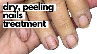 How to effectively condition dry brittle nails Start TODAY [upl. by Stewart]