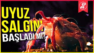 Uyuz Salgını Adını Duymak Bile Sizi Kaşındıracak [upl. by Anaahs]