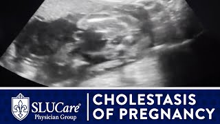 Cholestasis of Pregnancy Treating Itchy Hands amp Preventing Still Birth  SLUCare OBGYN [upl. by Eiblehs]