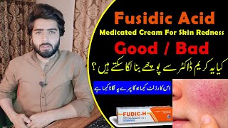 Fudic H Fusidic Acid Cream Uses  Side Effects  How to Use Fudic H Cream  Beauty Facts [upl. by Thunell]