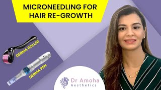 Microneedling for Hair Loss  Does It Works  डर्मा रोलर से बाल उगने के फायदे  Dr Amoha Bhatia [upl. by Tratner]