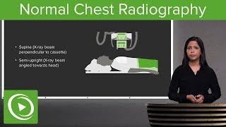 Normal Chest Radiography – Radiology  Lecturio [upl. by Ehcadroj]