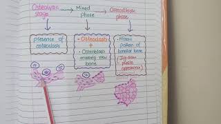 Pagets Disease Of Bone  Pathology [upl. by Lamonica]