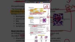 LYMPHOMA HODGKIN TYPE [upl. by Nwahsat73]