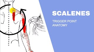 Scalenes Trigger Points [upl. by Burrows]