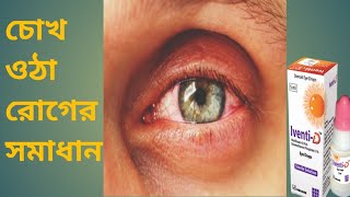 iventiD eye dropচোখ ওঠা রোগের সমাধান।BD health24 [upl. by Nosretep233]